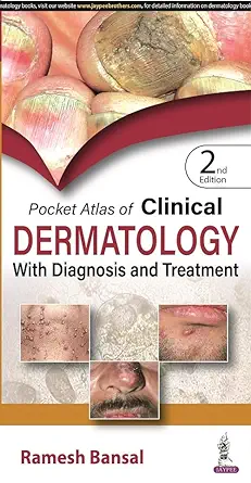 Pocket Atlas of Clinical Dermatology with Diagnosis and Treatment, 2nd Edition (Original PDF from Publisher)