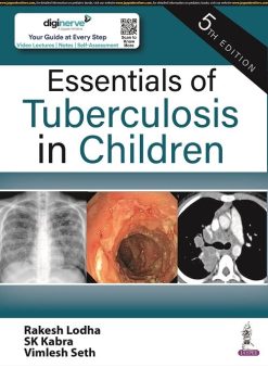 Essentials of Tuberculosis in Children, 5th Edition (Original PDF from Publisher)