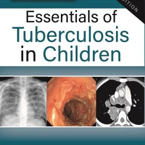 Essentials of Tuberculosis in Children, 5th Edition (Original PDF from Publisher)