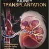 Textbook of Kidney Transplantation (Original PDF from Publisher)