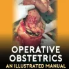 Operative Obstetrics: An Illustrated Manual (Original PDF from Publisher)