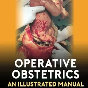 Operative Obstetrics: An Illustrated Manual (Original PDF from Publisher)