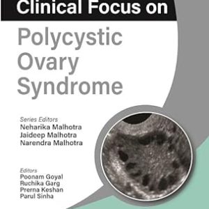 Clinical Focus on Polycystic Ovary Syndrome (ePub)