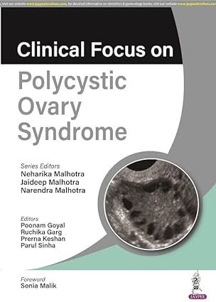 Clinical Focus on Polycystic Ovary Syndrome (ePub)