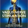 Vagus Nerve Stimulation (True PDF from Publisher)