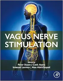 Vagus Nerve Stimulation (True PDF from Publisher)