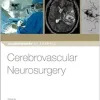 Cerebrovascular Neurosurgery (Neurosurgery by Example) (Original PDF from Publisher)