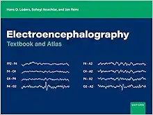 Electroencephalography: Textbook and Atlas (EPUB)