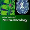 Oxford Textbook of Neuro-Oncology (Oxford Textbooks in Clinical Neurology), 2nd edition (Original PDF from Publisher)