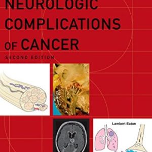 Neurologic Complications of Cancer (Contemporary Neurology Series Book 73), 2nd edition (Original PDF from Publisher)