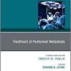 Treatment of Peritoneal Metastasis, An Issue of Surgical Oncology Clinics of North America (Volume 27-3) (The Clinics: Surgery, Volume 27-3) (Original PDF from Publisher)