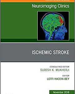Ischemic Stroke, An Issue of Neuroimaging Clinics of North America (Volume 28-4) (The Clinics: Radiology, Volume 28-4) (Original PDF from Publisher)