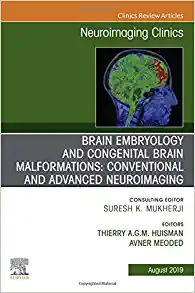 Brain Embryology and the Cause of Congenital Malformations, An Issue of Neuroimaging Clinics of North America (Volume 29-3) (The Clinics: Radiology, Volume 29-3) (Original PDF from Publisher)