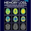 Memory Loss, Alzheimer’s Disease and Dementia: A Practical Guide for Clinicians, 3rd Edition (EPUB)