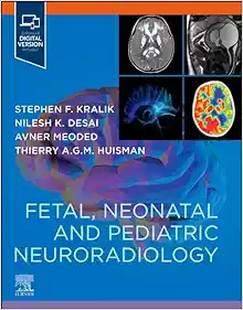 Fetal, Neonatal and Pediatric Neuroradiology (True PDF from Publisher)