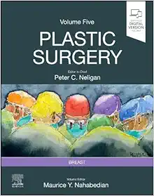 Plastic Surgery: Volume 5: Breast, 5th edition (True PDF)
