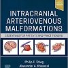 Intracranial Arteriovenous Malformations: Essentials for Patients and Practitioners (ePub+Converted PDF)