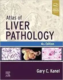 Atlas of Liver Pathology, 4th Edition (True PDF from Publisher)