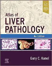 Atlas of Liver Pathology, 4th edition (True PDF)