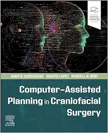 Computer-Assisted Planning in Craniofacial Surgery (True PDF from Publisher)