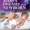Avery’s Diseases of the Newborn, 11th Edition (True PDF from Publisher)