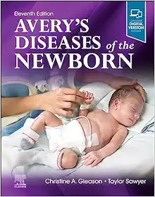 Avery’s Diseases of the Newborn, 11th Edition (True PDF from Publisher)