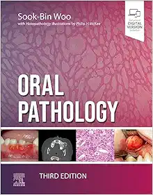 Oral Pathology, 3rd Edition (True PDF from Publisher)