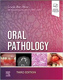 Oral Pathology, 3rd edition (True PDF)