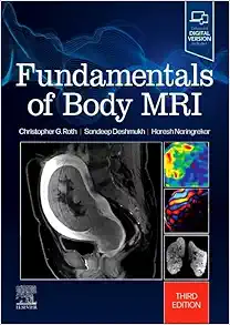 Fundamentals of Body MRI (Fundamentals of Radiology), 3rd edition (EPUB + Converted PDF)