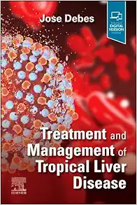 Treatment and Management of Tropical Liver Disease (True PDF from Publisher)