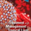 Treatment and Management of Tropical Liver Disease (ePub+Converted PDF)