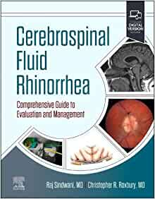 Cerebrospinal Fluid Rhinorrhea: Comprehensive Guide to Evaluation and Management (Original PDF from Publisher)