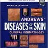 Andrews’ Diseases of the Skin: Clinical Dermatology, 14th edition (EPUB + Converted PDF)