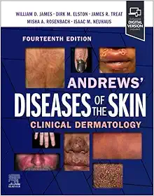 Andrews’ Diseases of the Skin: Clinical Dermatology, 14th edition (EPUB + Converted PDF)