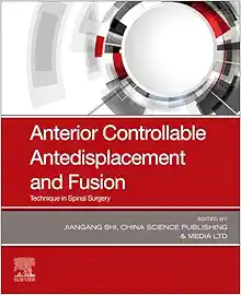 Anterior Controllable Antedisplacement and Fusion: Technique in Spinal Surgery (Original PDF from Publisher)