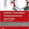 Anterior Controllable Antedisplacement and Fusion: Technique in Spinal Surgery (EPUB)