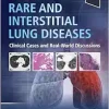 Rare and Interstitial Lung Diseases: Clinical Cases and Real-World Discussions (Original PDF from Publisher)