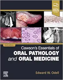 Cawson’s Essentials of Oral Pathology and Oral Medicine, 10th Edition (True PDF from Publisher)