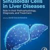 Sinusoidal Cells in Liver Diseases: Role in their Pathophysiology, Diagnosis, and Treatment (Original PDF from Publisher)