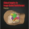 Clinical Insights for Image-Guided Radiotherapy (Series in Medical Physics and Biomedical Engineering) (Original PDF from Publisher)
