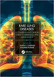 Rare Lung Diseases: A Comprehensive Clinical Guide to Diagnosis and Management (Original PDF from Publisher)