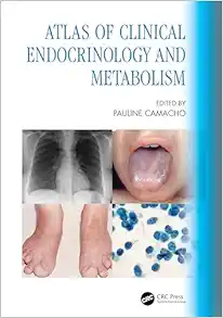 Atlas of Clinical Endocrinology and Metabolism (EPUB)