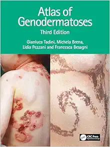 Atlas of Genodermatoses, 3rd Edition (EPUB)
