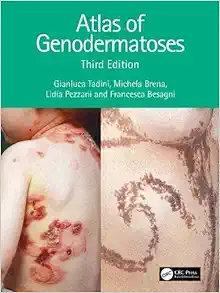 Atlas of Genodermatoses 3e (Original PDF from Publisher)