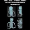 Fetal and Perinatal Skeletal Dysplasias: An Atlas of Multimodality Imaging 2e (Original PDF from Publisher)