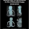 Fetal and Perinatal Skeletal Dysplasias: An Atlas of Multimodality Imaging, 2nd Edition (Original PDF from Publisher)
