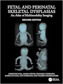 Fetal and Perinatal Skeletal Dysplasias: An Atlas of Multimodality Imaging 2e (Original PDF from Publisher)