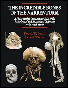 The Incredible Bones of the Narrenturm: Photographic Comparative Atlas of the Pathological and Anatomical Collection of the Fool’s Tower (Original PDF from Publisher)