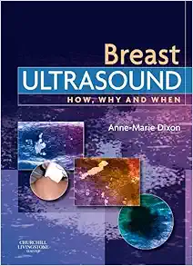 Breast Ultrasound: How, Why and When (EPUB)