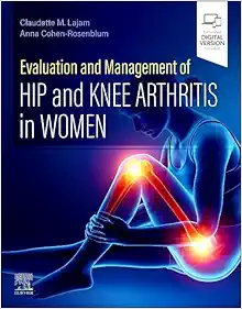 Evaluation and Management of Hip and Knee Arthritis in Women (Original PDF from Publisher)